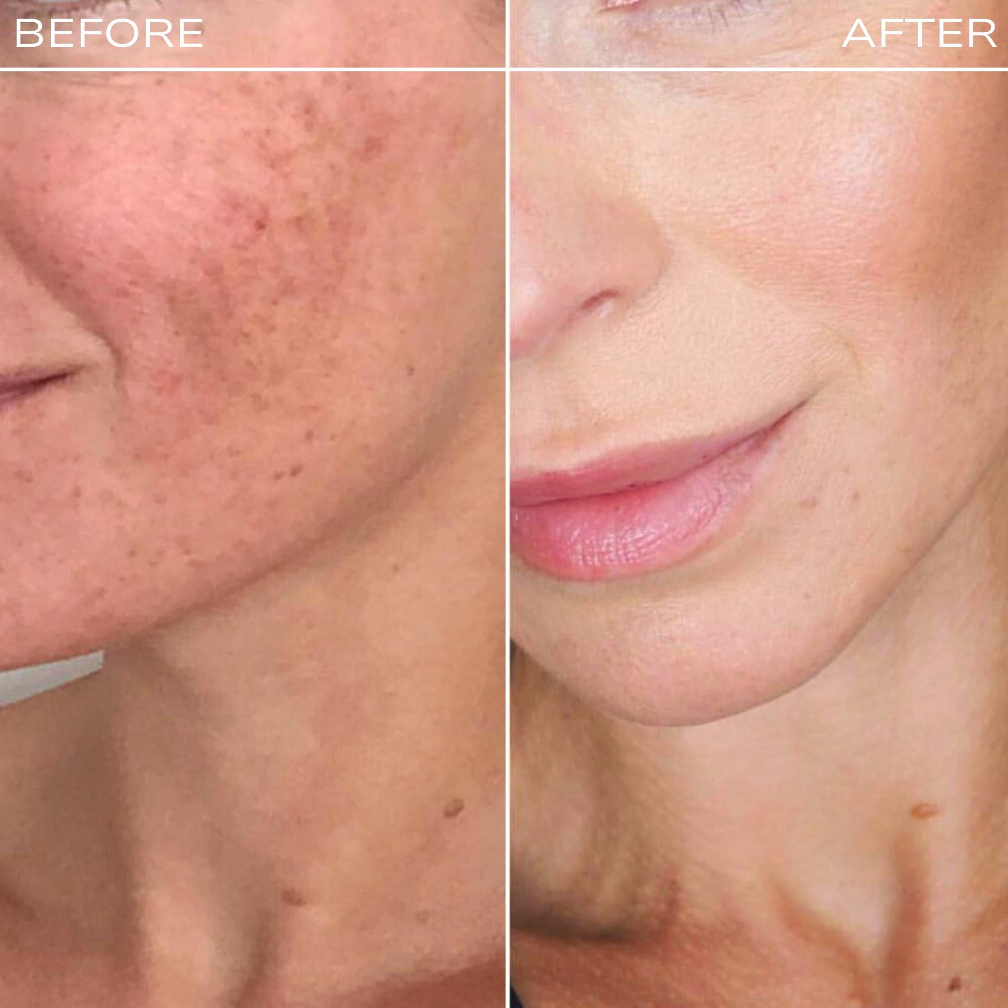 Cloud Ceramide + HA Recovery Balm + Cloud Collagen Oil Duo