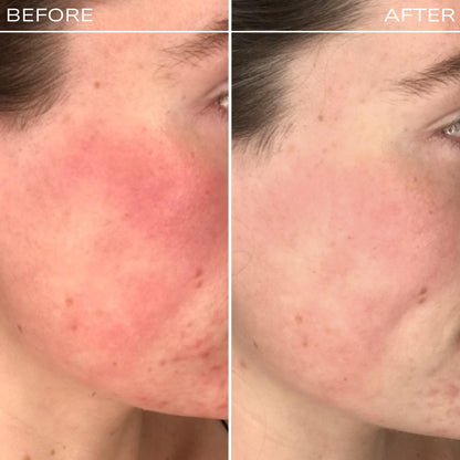 Redness Rescue Cream + Green Loose Setting Powder Duo